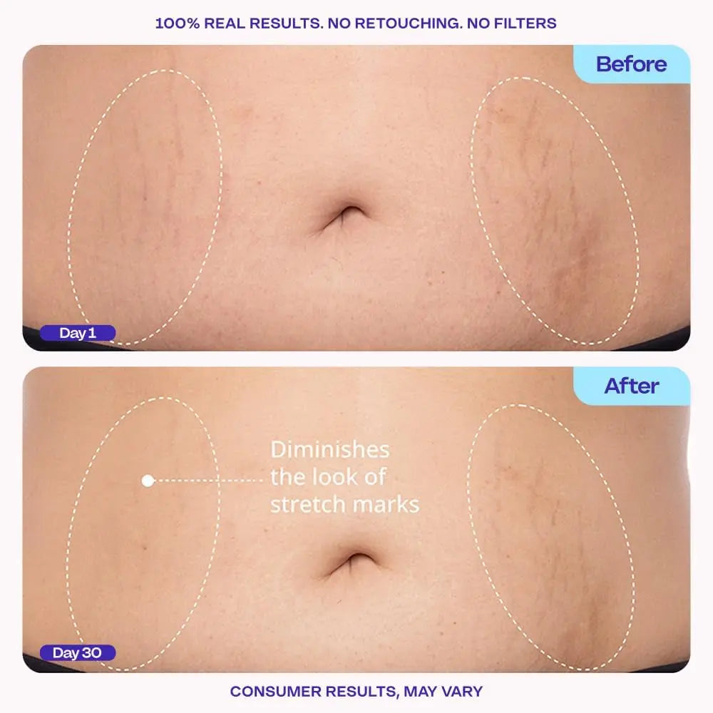 Firming Belly Cream - Body Firming Moisturizer for Visible Cellulite & Stretch Mark Reduction, 4.25Oz