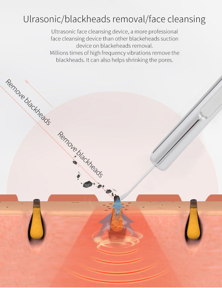 Ultrasonic EMS Facial Skin Scrubber