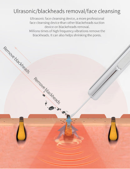 Ultrasonic EMS Facial Skin Scrubber