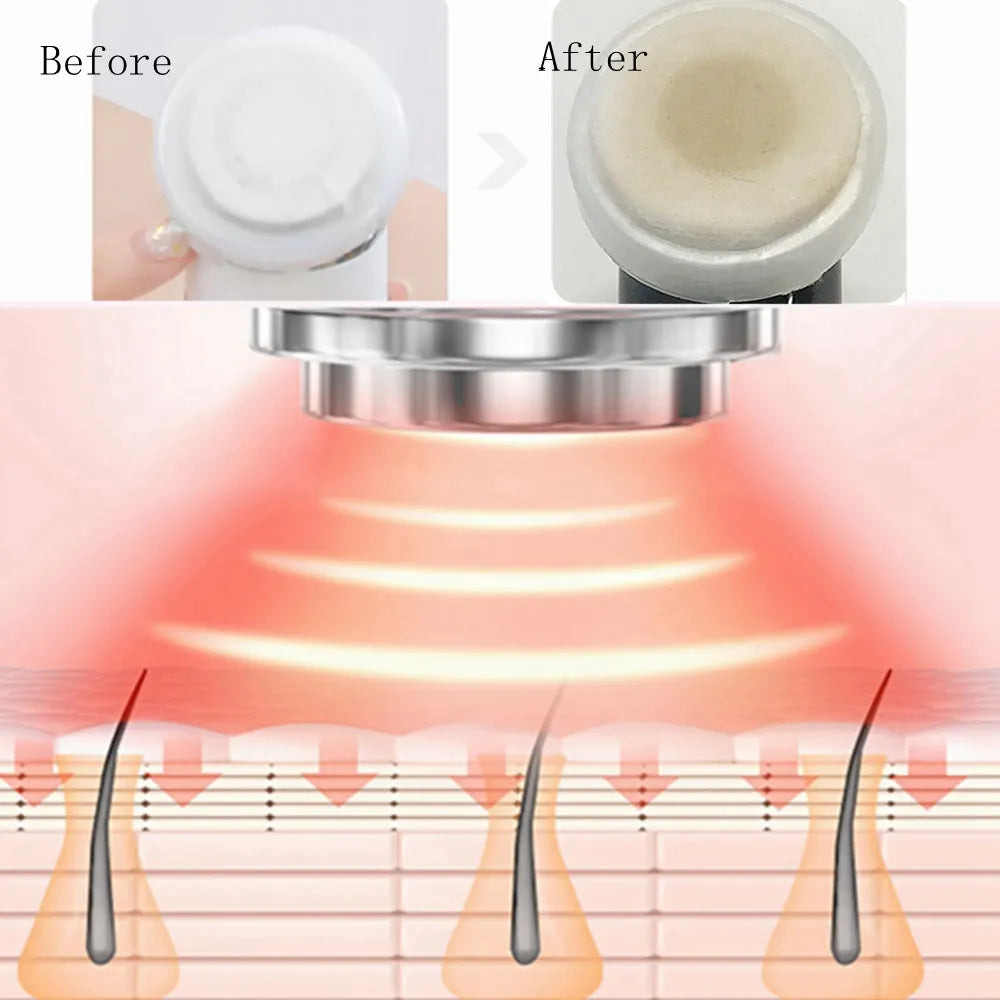 Mesotherapy Facial Massager