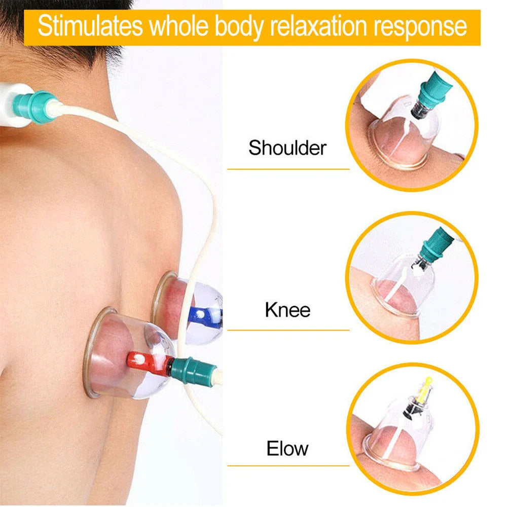 Cupping Massage Cups Therapy Set – Effective Pain Relief Therapy