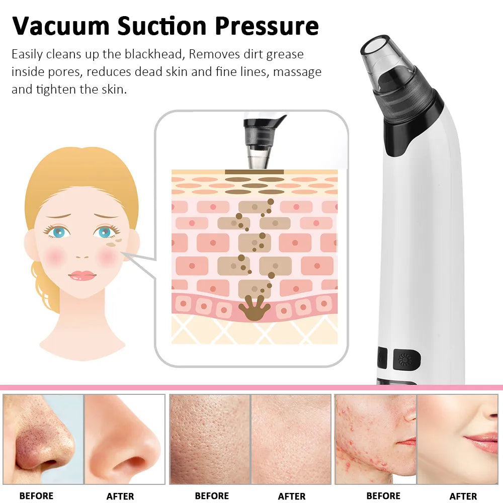Electric Pore Vacuum Cleaner