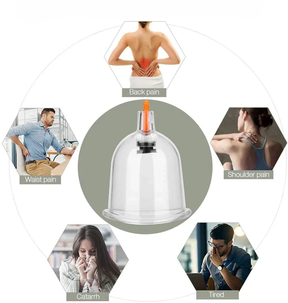 Cupping Massage Cups Therapy Set – Effective Pain Relief Therapy