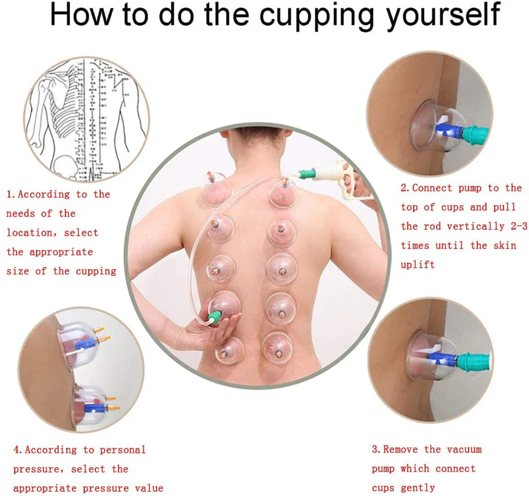 Cupping Massage Cups Therapy Set – Effective Pain Relief Therapy