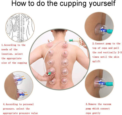 Cupping Massage Cups Therapy Set – Effective Pain Relief Therapy