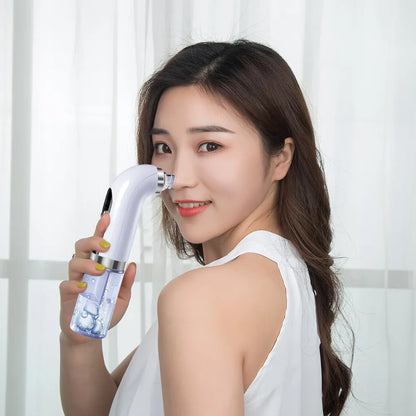 Bubble Blackhead Remover