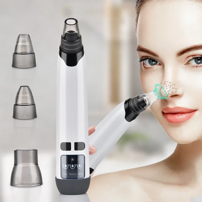 Electric Pore Vacuum Cleaner