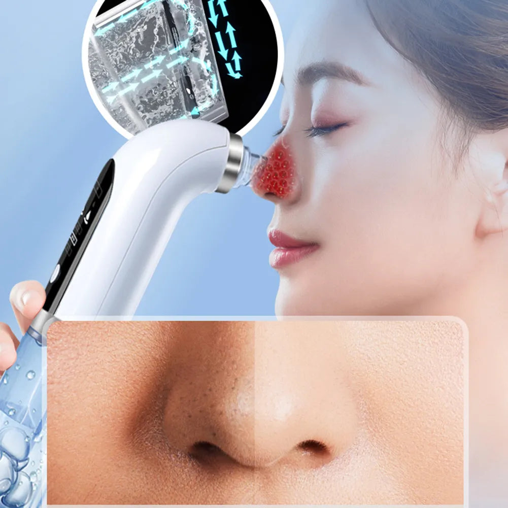 Bubble Blackhead Remover