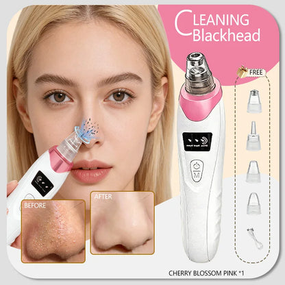 Blackhead Remover Vacuum