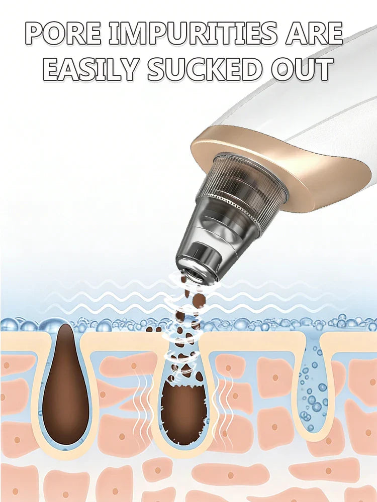 Blackhead Remover Vacuum