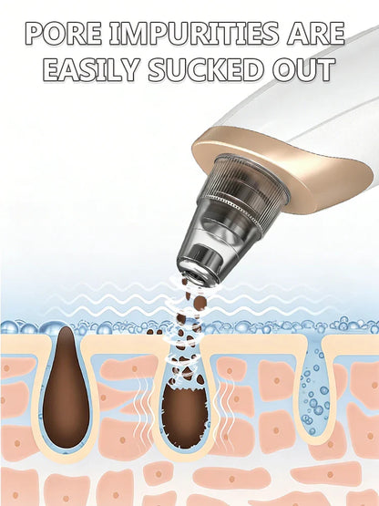 Blackhead Remover Vacuum