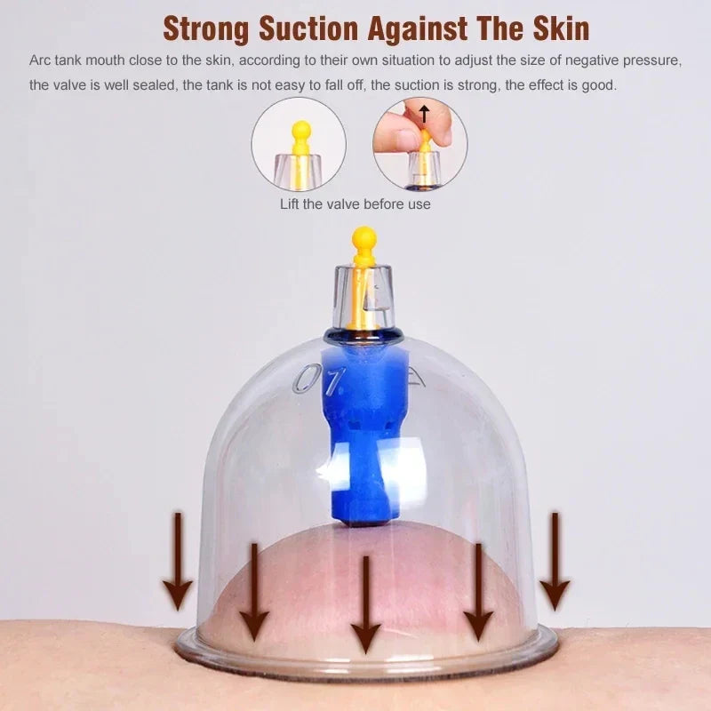 32 Piece Vacuum Cupping Therapy Set
