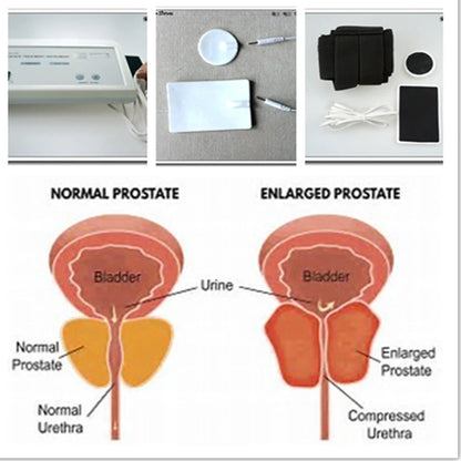 Prostate Massager QLX01 For Urinary Frequency Therapy