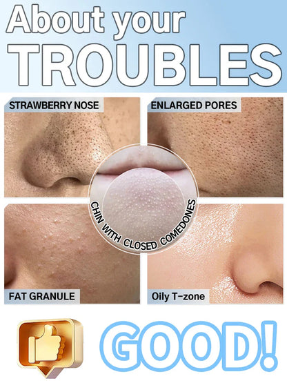 Blackhead Remover Vacuum