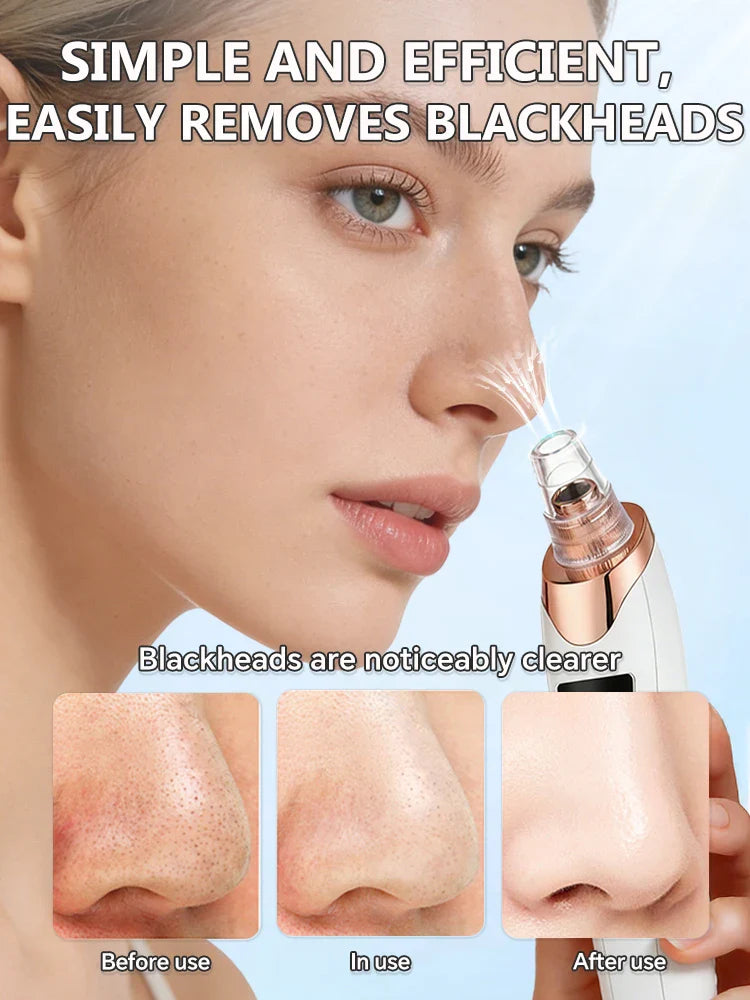 Blackhead Remover Vacuum