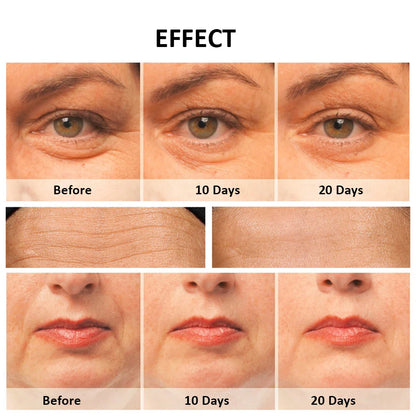RF Facial Massager for Skin Tightening and Lifting with EMS Microcurrent