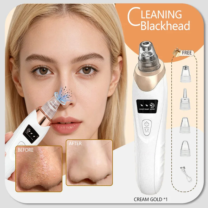 Blackhead Remover Vacuum