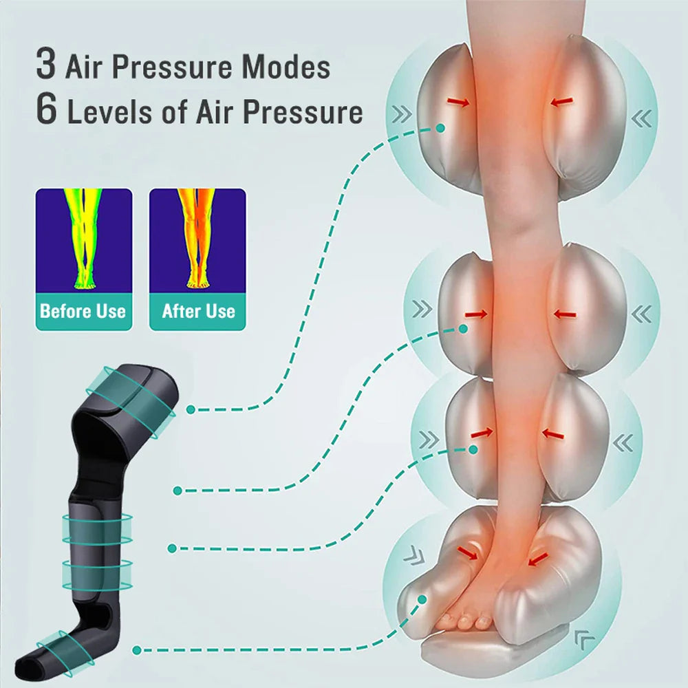 ALC472 Pressotherapy Leg Massager – Rechargeable Battery