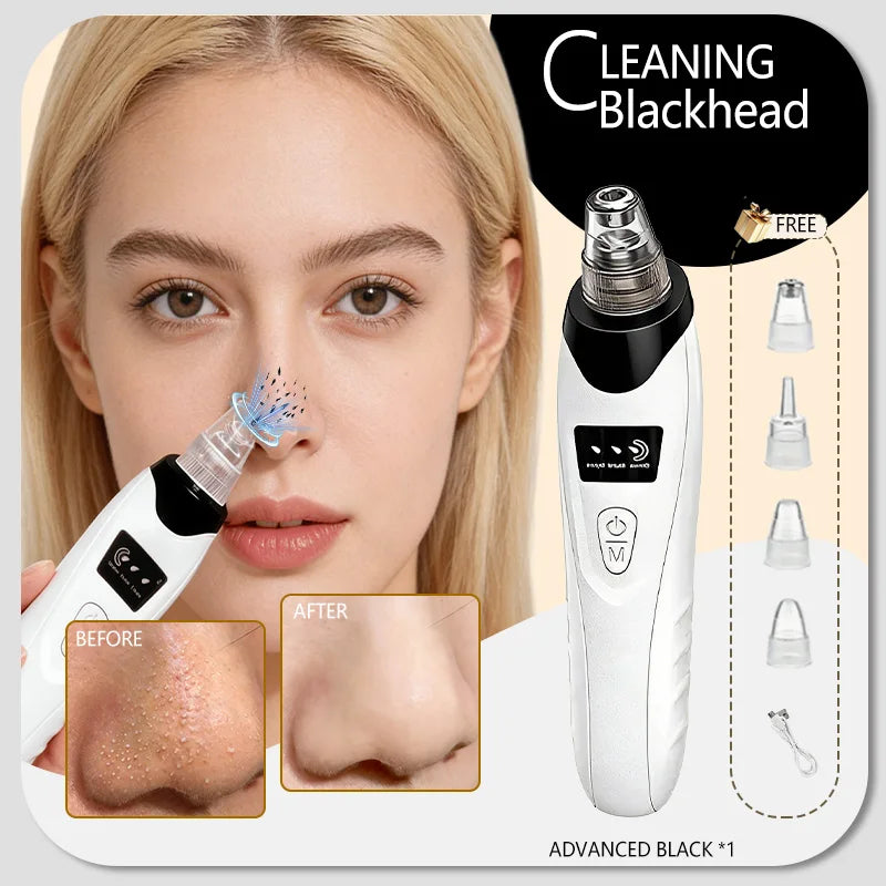 Blackhead Remover Vacuum