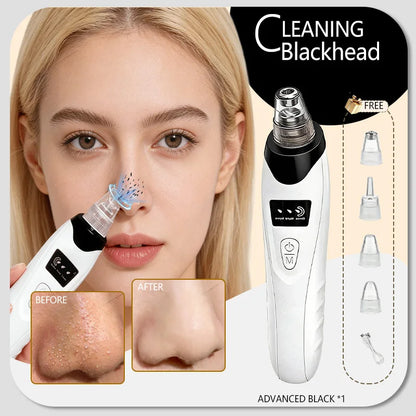 Blackhead Remover Vacuum