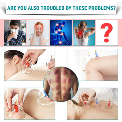 32 Piece Vacuum Cupping Therapy Set