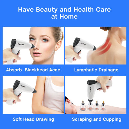 Electric Cupping Set – Vacuum Therapy Massage for Body