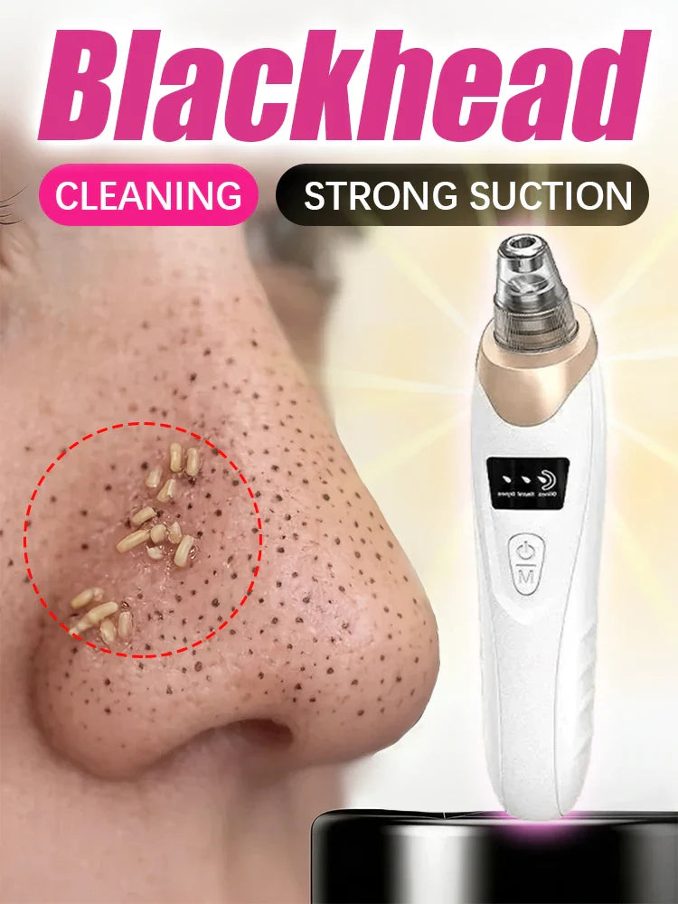 Blackhead Remover Vacuum