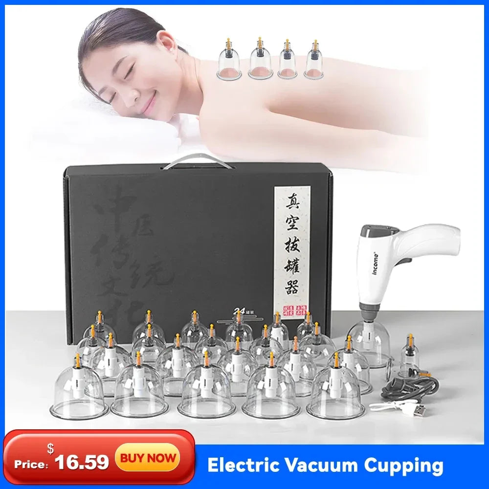 Electric Cupping Set – Vacuum Therapy Massage for Body