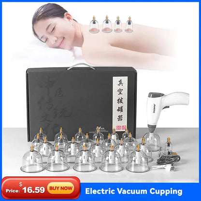 Electric Cupping Set – Vacuum Therapy Massage for Body