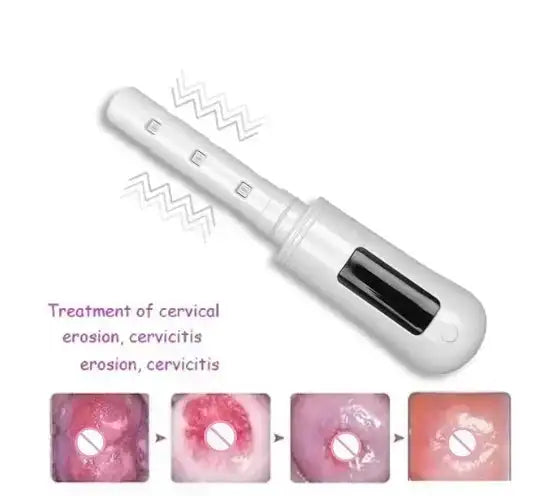 Gynecological LED Red Blue Therapy Massage Inflammation