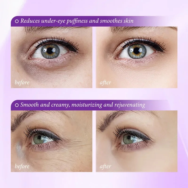 Retinol Firming Eye Cream