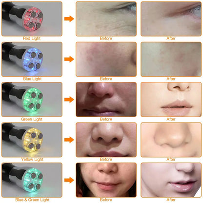 MONAI Face Massager – LED Photon Therapy For Firming