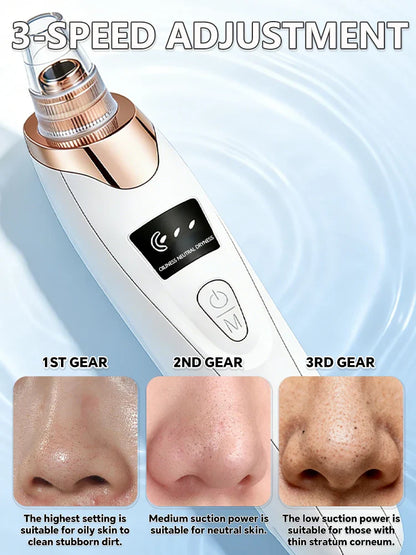 Blackhead Remover Vacuum