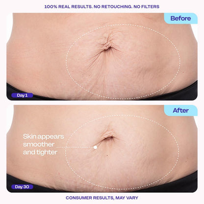 Firming Belly Cream - Body Firming Moisturizer for Visible Cellulite & Stretch Mark Reduction, 4.25Oz