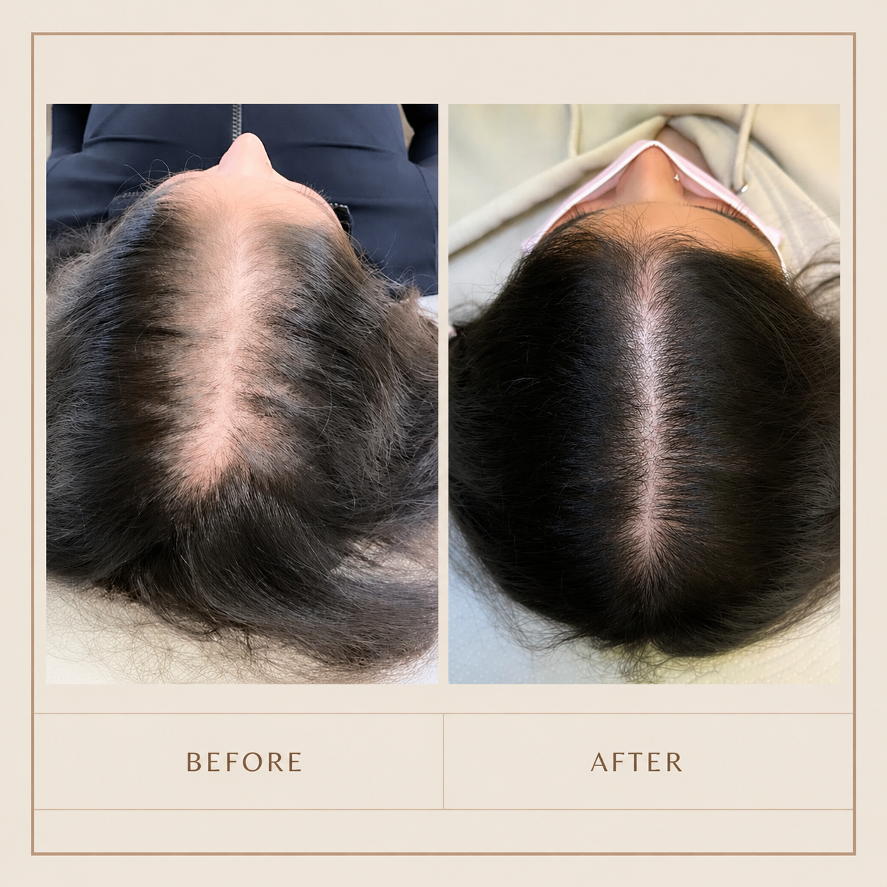 Biotin Hair Serum for Hair Growth & Thinning Hair – Strengthening Hair Treatment for Fuller, Thicker Hair & Scalp Nourishment