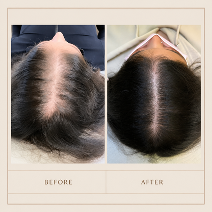 Biotin Hair Serum for Hair Growth & Thinning Hair – Strengthening Hair Treatment for Fuller, Thicker Hair & Scalp Nourishment