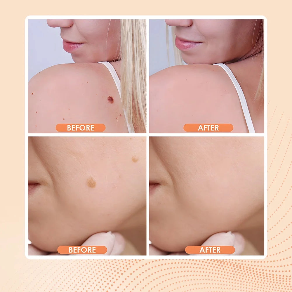 Skin Spot & Blemish Beauty Pen