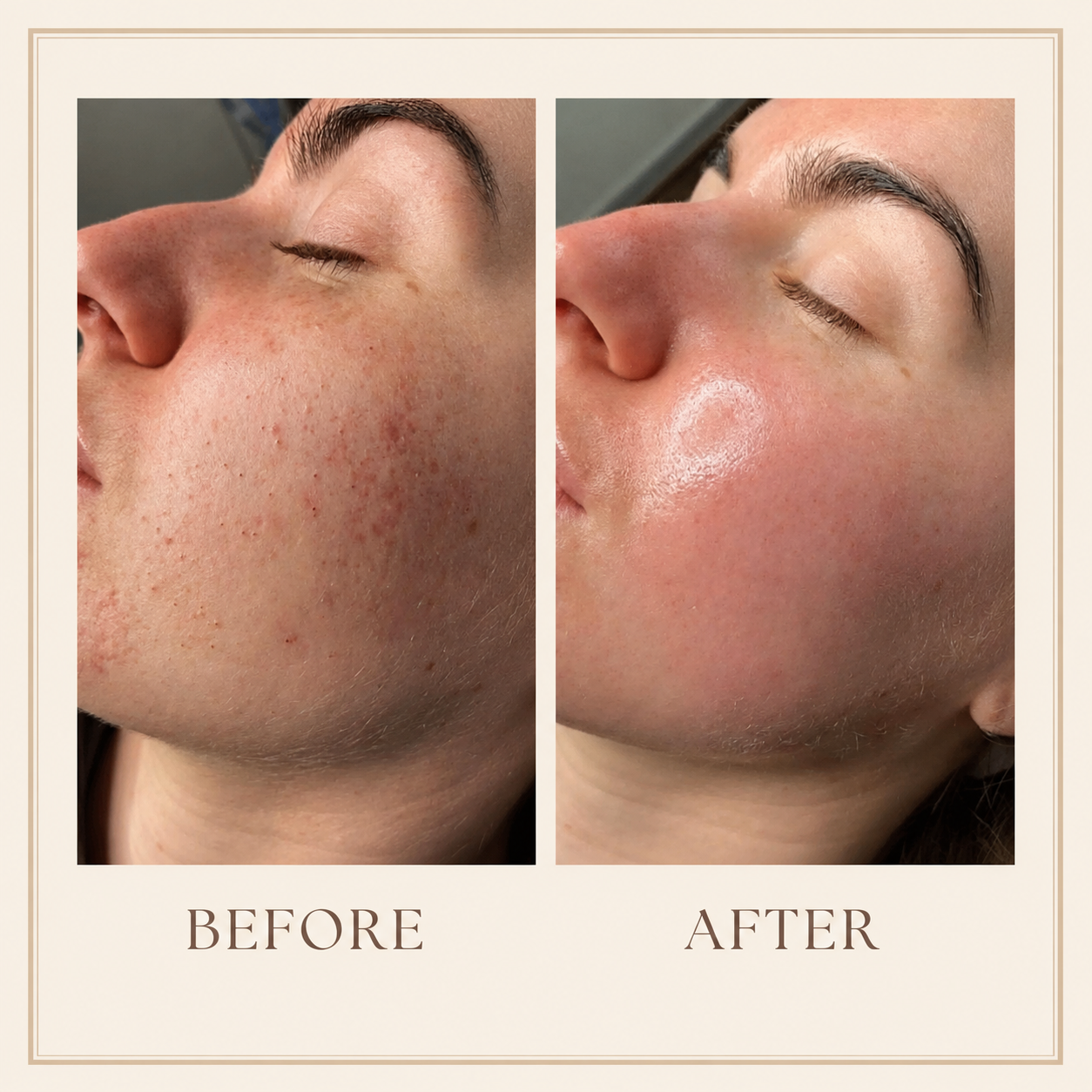 Hyaluronic Acid Face Cream for Deep Hydration – Moisturizing Cream for Dry Skin, Plumping, Smoothing & Long Lasting Skin Hydration