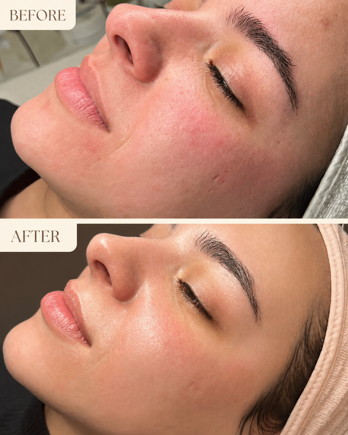 Norya Facial Steamer for Deep Cleansing & Pore Opening – At-Home Spa Face Steamer