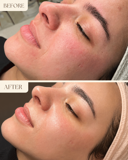 Norya Facial Steamer for Deep Cleansing & Pore Opening – At-Home Spa Face Steamer