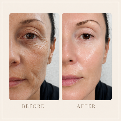 Copper Peptides Serum for Face – Anti Aging Wrinkle Repair Serum with Hyaluronic Acid for Skin Tightening, Hydration & Firming Treatment